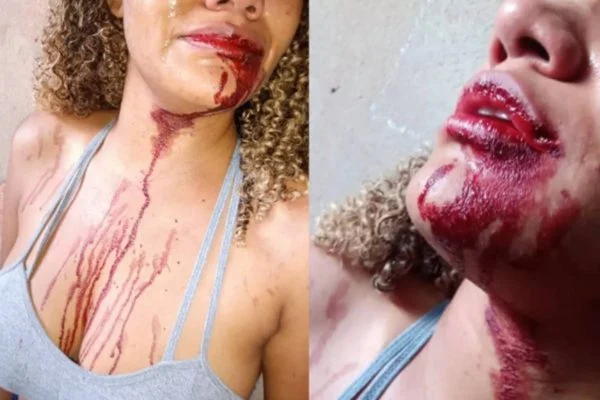 Sargento dá soco na boca de mulher durante abordagem e polícia civil investiga