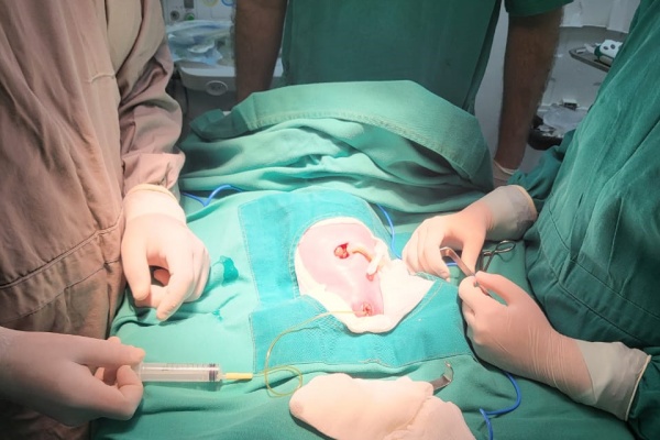 Cirurgia inédita no Alarico Pacheco salva vida de criança recém nascida